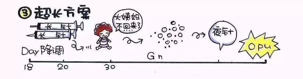 常见的促排方案有哪些？